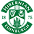 Hearts vs Hibernian Match - Predictions, Betting Tips & Match Preview